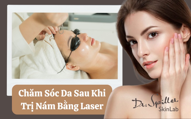 Hướng dẫn cách chăm sóc da sau khi trị nám bằng laser