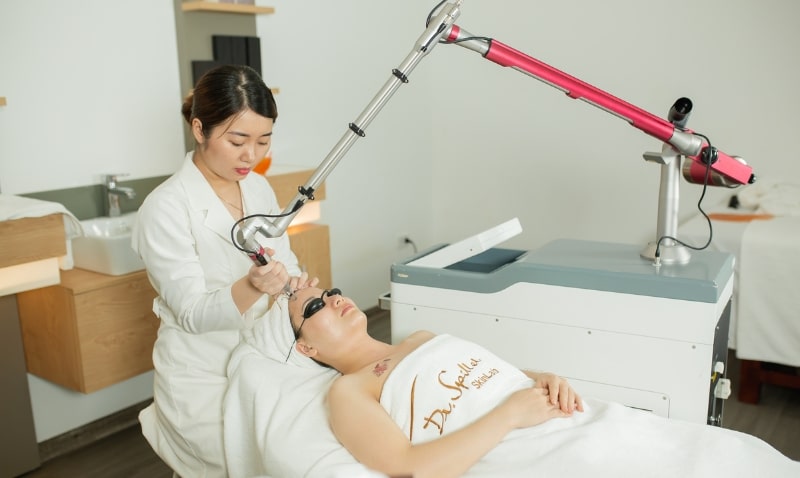 Điều trị nám nhẹ bằng công nghệ Laser Q-Switch tại Dr Spiller Skinlab
