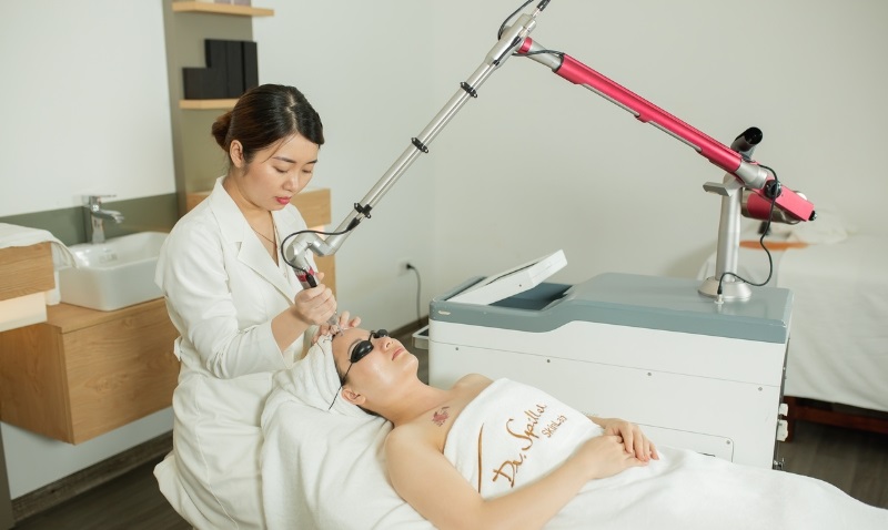 Cách điều trị nám chân sâu tại spa bằng công nghệ Laser Q-Switch tại Dr Spiller Skinlab