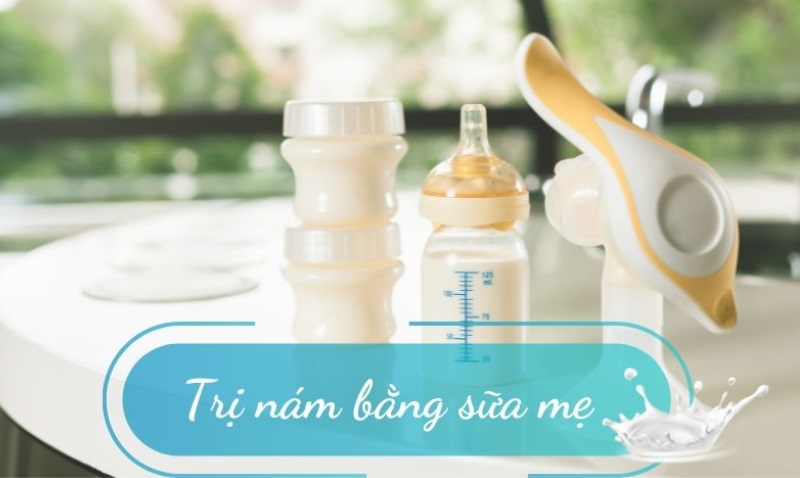 Trị nám da sau sinh bằng sữa mẹ hiệu quả và an toàn cho mẹ bỉm sữa