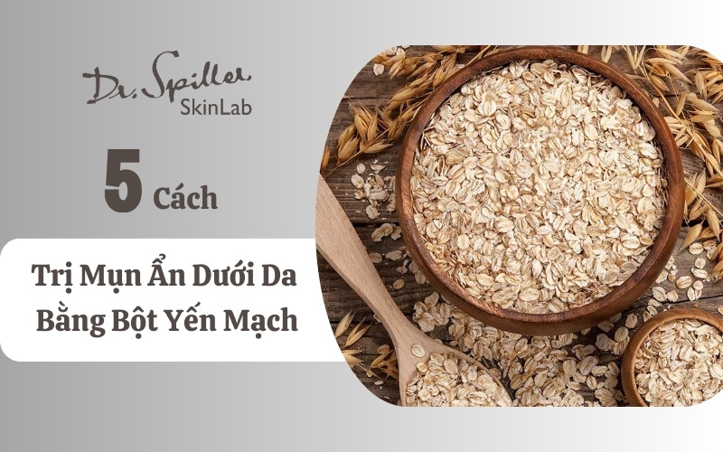 Bạn đã biết cách trị mụn ẩn dưới da bằng bột yến mạch hay chưa?
