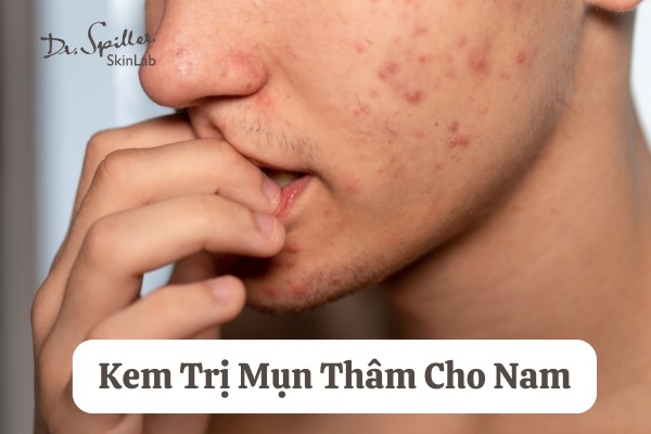 Cách lựa chọn và sử dụng kem trị mụn thâm cho nam đúng chuẩn
