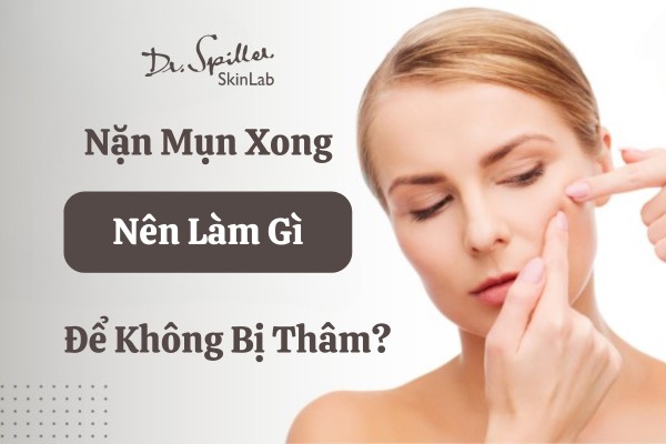 [GÓC GIẢI ĐÁP] Nặn mụn xong nên làm gì để không bị thâm?