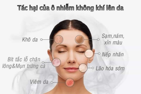 Sinh sống trong môi trường ô nhiễm là nguyên nhân gây mụn trứng cá trên da