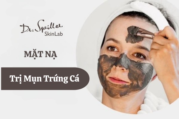 Bật mí các loại mặt nạ trị mụn trứng cá cho hiệu quả bất ngờ