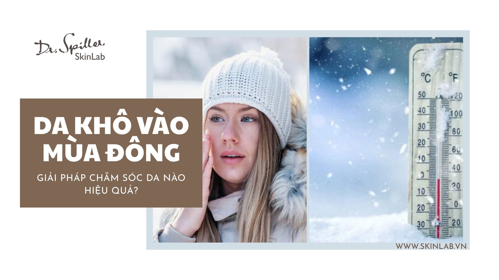 Da khô vào mùa đông có thể do những nguyên nhân nào?