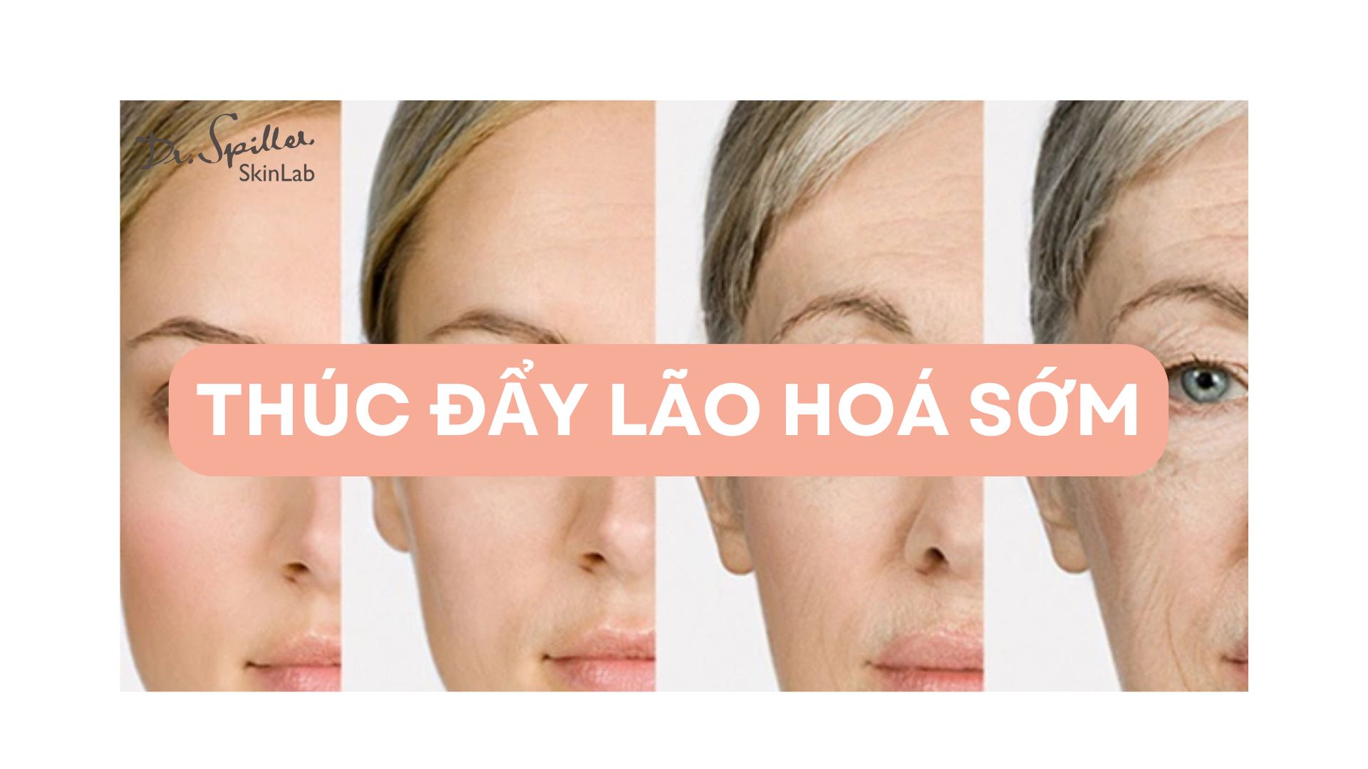 Da mặt khô căng thúc đẩy quá trình lão hóa sớm