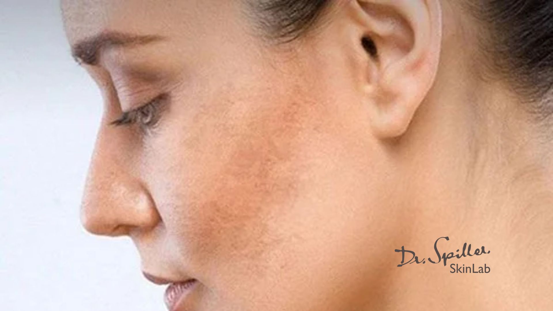 Phân biệt da mặt khô thiếu nước hay thiếu ẩm