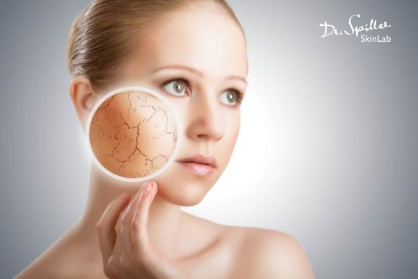 Thiếu hụt collagen khiến da mặt bị sần sùi, khô ráp, bong tróc