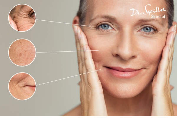 Tiêm PRP để giải quyết các dấu hiệu lão hóa trên da