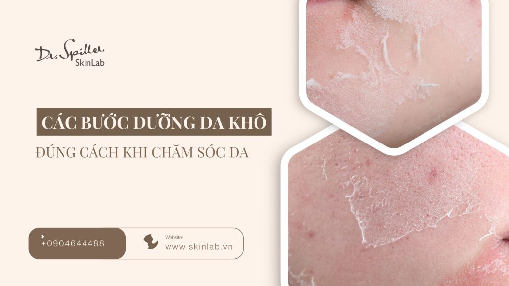 Các bước dưỡng da khô đúng cách giúp da mềm mịn tự nhiên