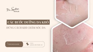 Các bước dưỡng da khô đúng cách giúp da mềm mịn tự nhiên