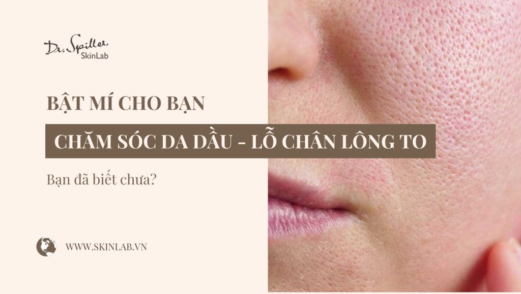 Cách trị da dầu và lỗ chân lông to an toàn, hiệu quả