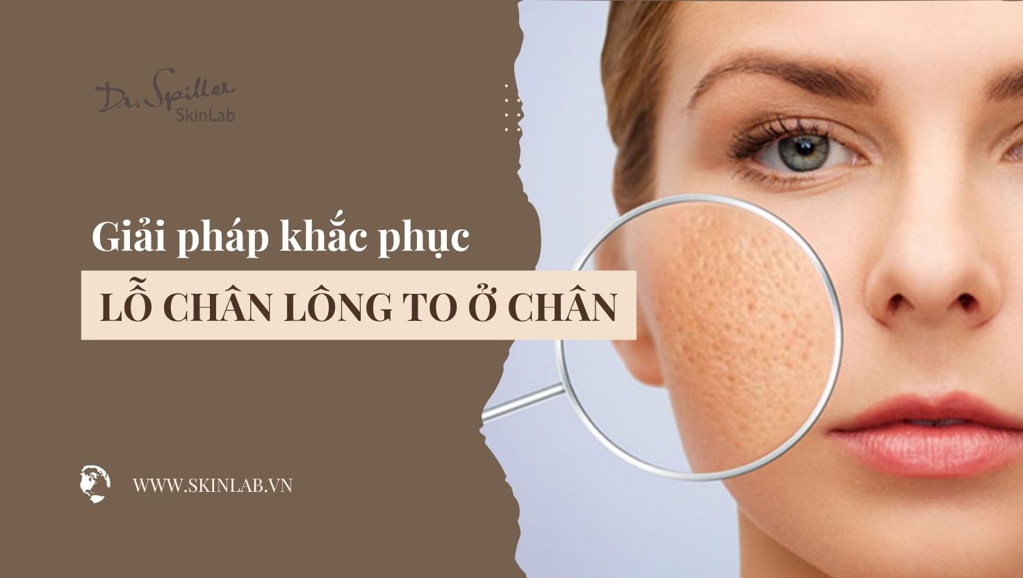 Cách trị lỗ chân lông to hiệu quả, an toàn và lâu dài