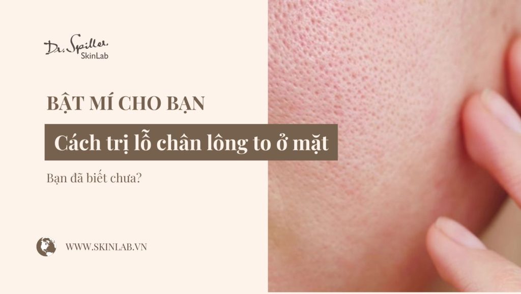 Cách trị lỗ chân lông to ở mặt hiệu quả, an toàn tại nhà và spa