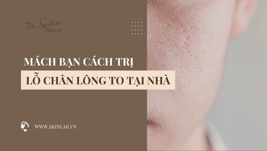 Cách trị lỗ chân lông to tại nhà hiệu quả và dễ thực hiện