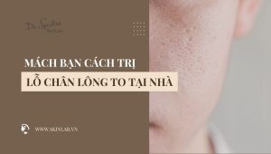 Cách trị lỗ chân lông to tại nhà hiệu quả và dễ thực hiện
