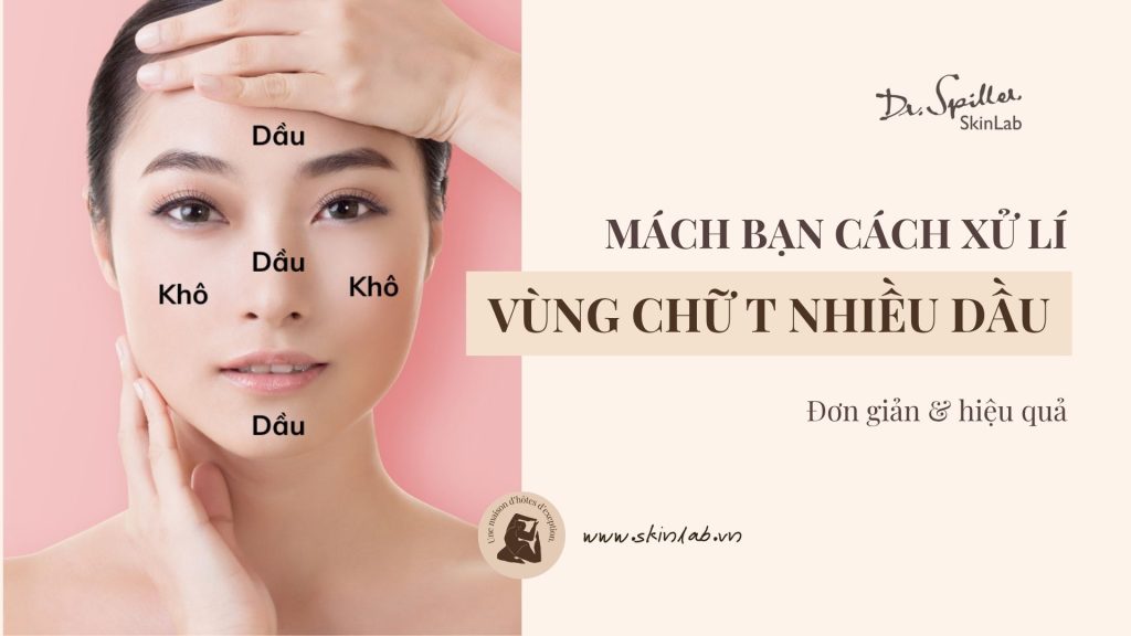 Cách xử lý vùng chữ T bị dầu hiệu quả và an toàn