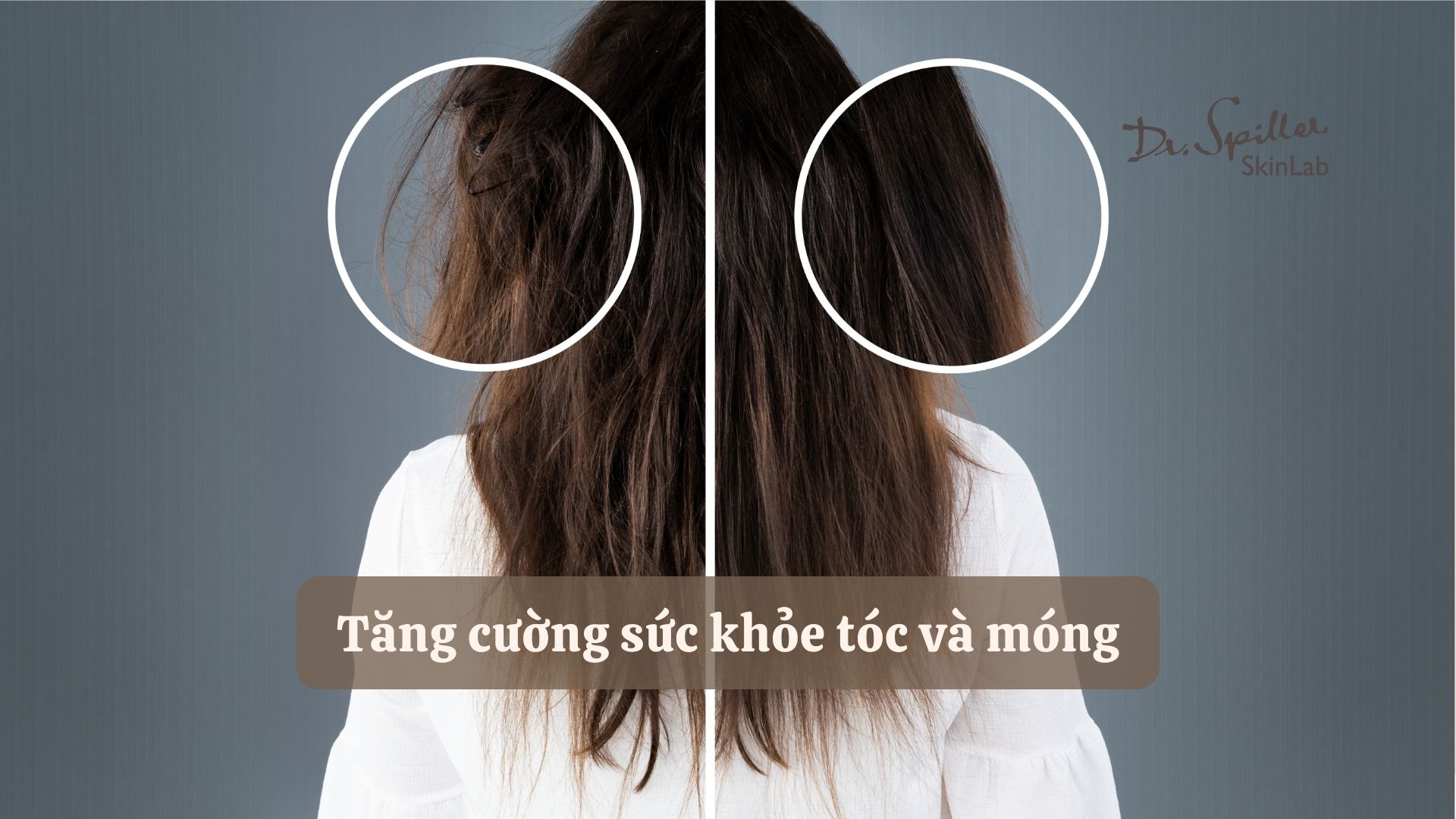 Collagen thuỷ phân chống lão hoá, tăng cường sức khỏe tóc và móng