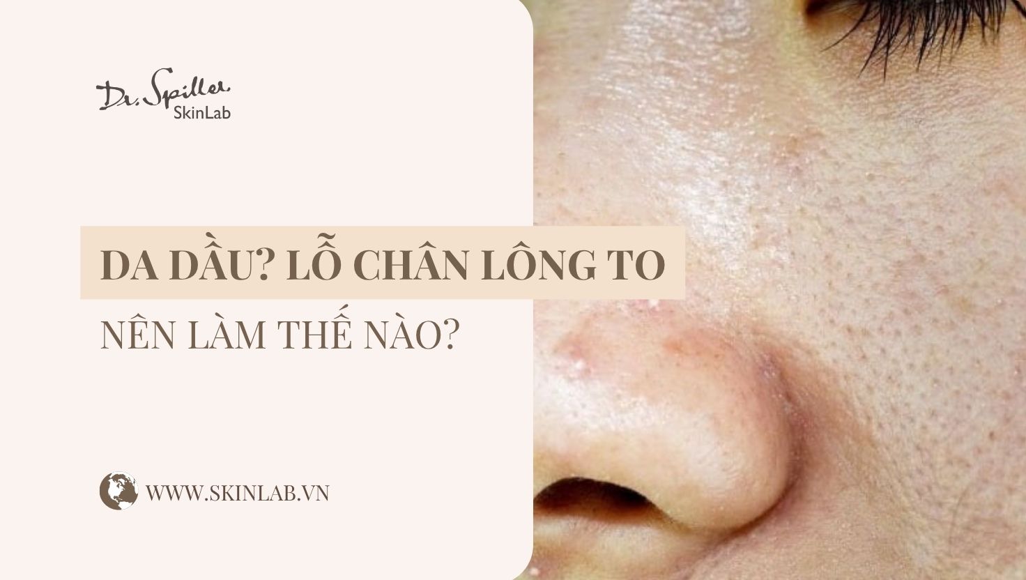 Cách chăm sóc da dầu lỗ chân lông to hiệu quả tại spa