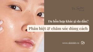 Da hỗn hợp khác gì da dầu? Phân biệt & chăm sóc đúng cách