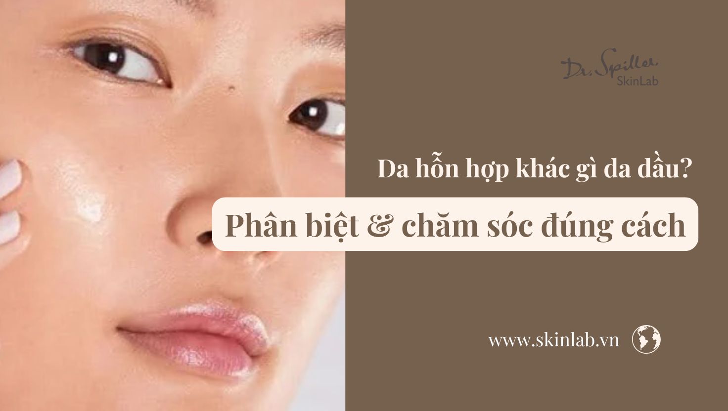Da hỗn hợp khác gì da dầu? Phân biệt & chăm sóc đúng cách