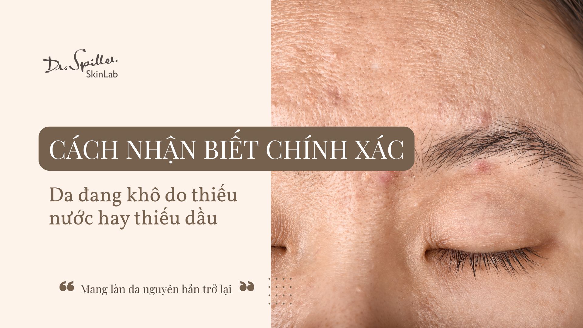 Nguyên nhân gây khô da: Thiếu nước hay thiếu dầu?