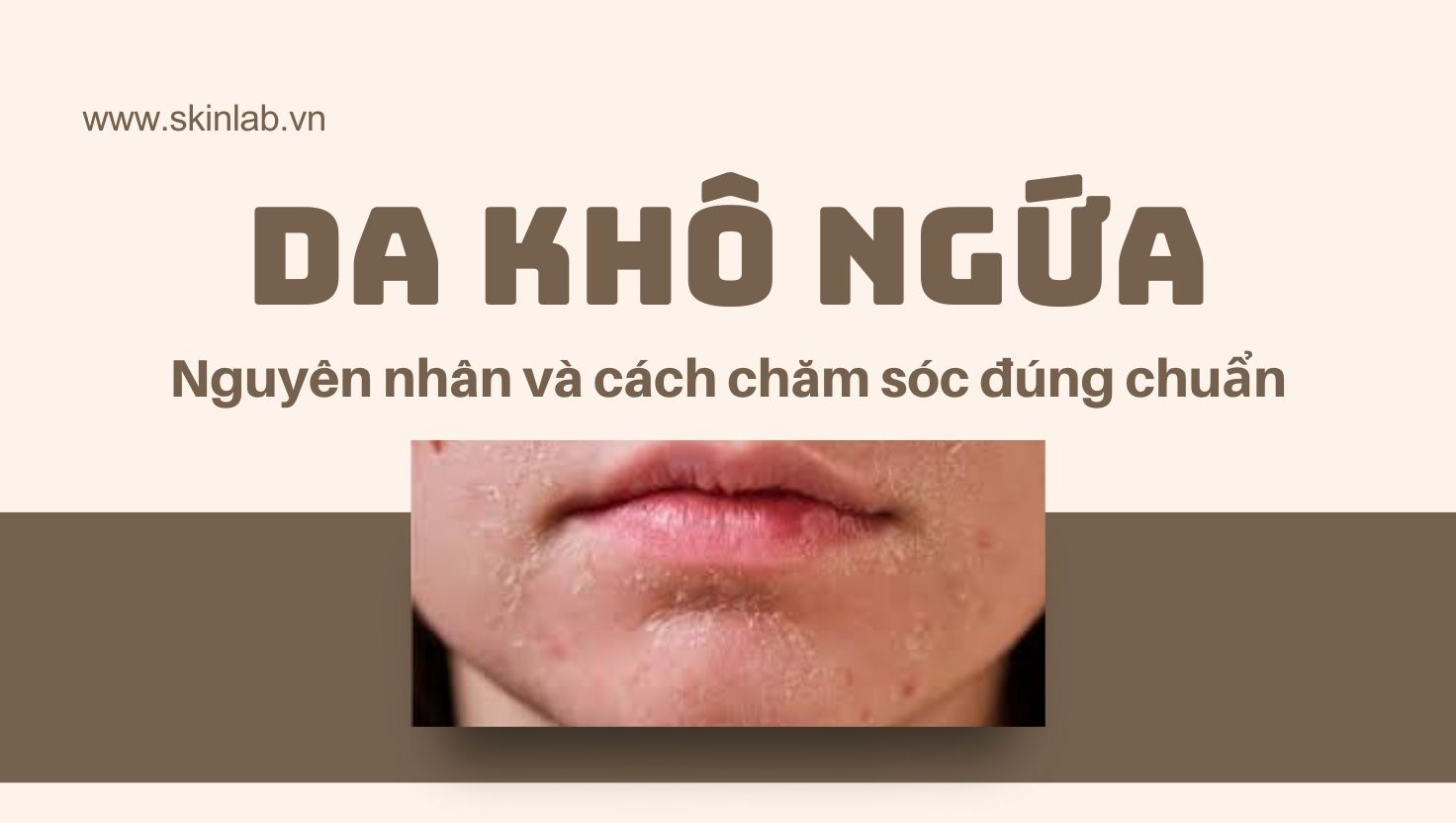Da khô ngứa: Nhận diện đúng triệu chứng để xử lý hiệu quả