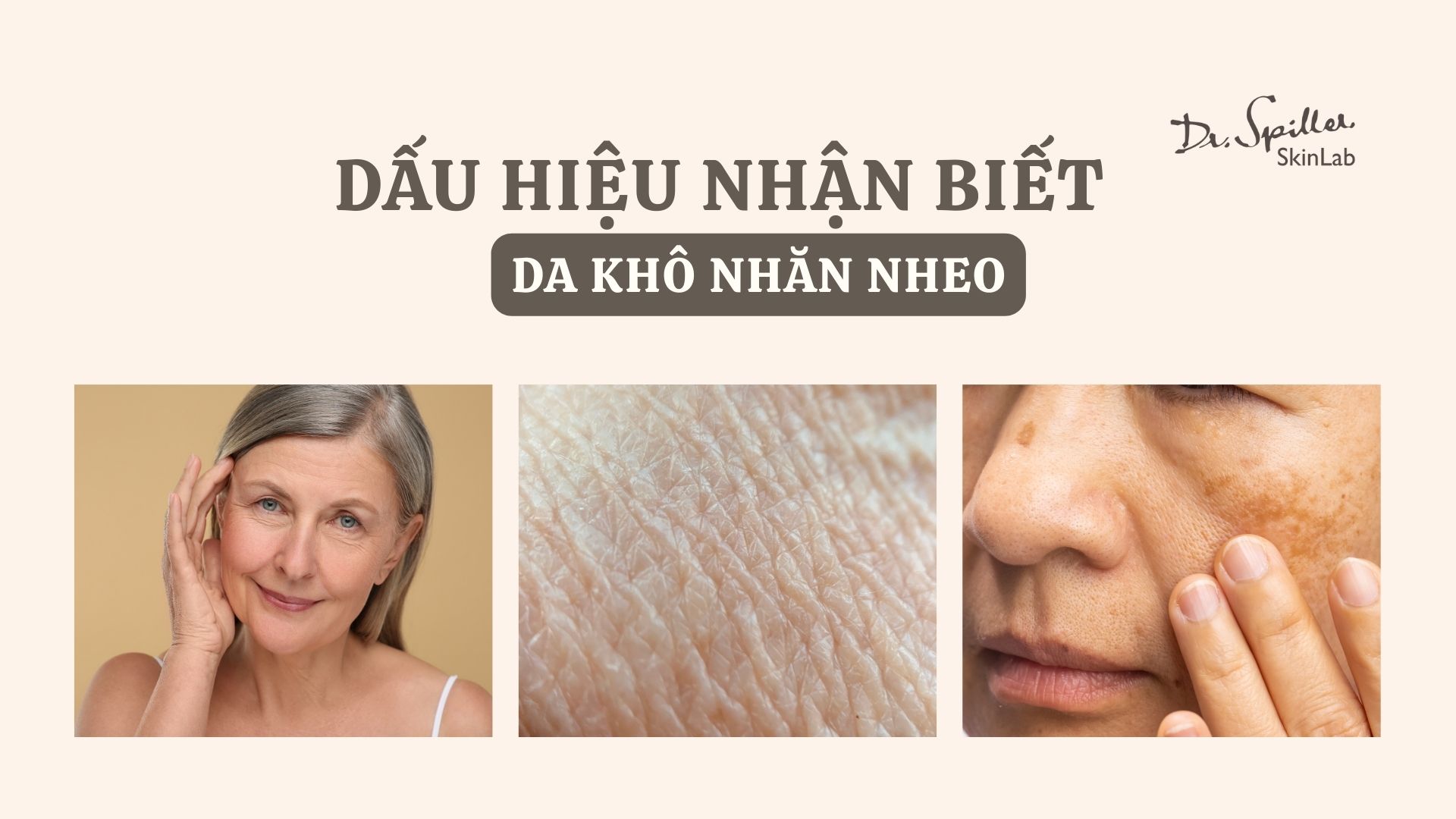 Dấu hiệu nhận biết da khô nhăn nheo