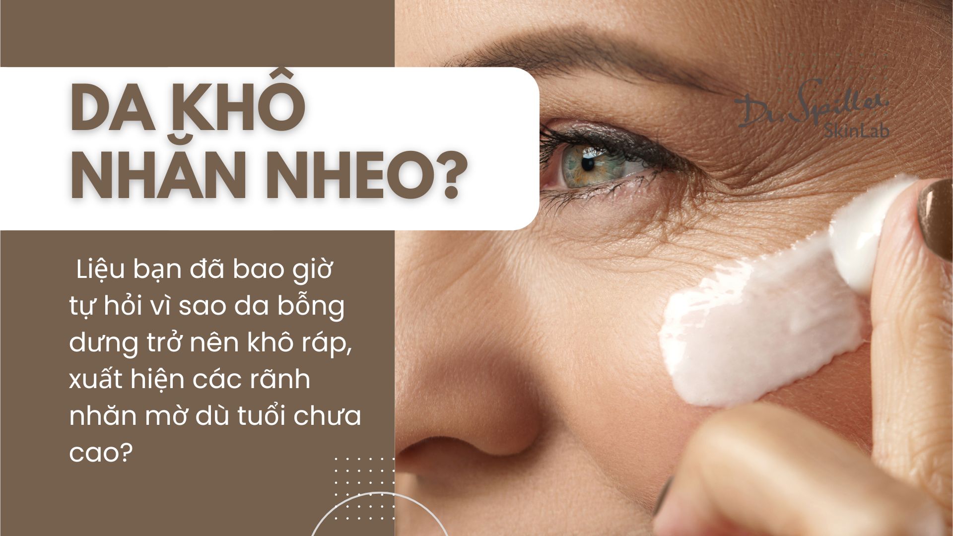 Da khô nhăn nheo: Cách phục hồi và dưỡng ẩm hiệu quả