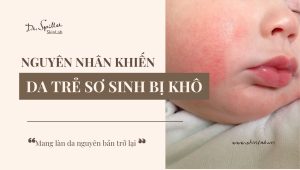 Da khô ở trẻ sơ sinh: nguyên nhân & cách chăm sóc hiệu quả