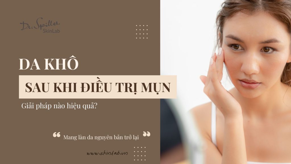 Giải pháp phục hồi da khô sau điều trị mụn hiệu quả