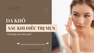 Giải pháp phục hồi da khô sau điều trị mụn hiệu quả