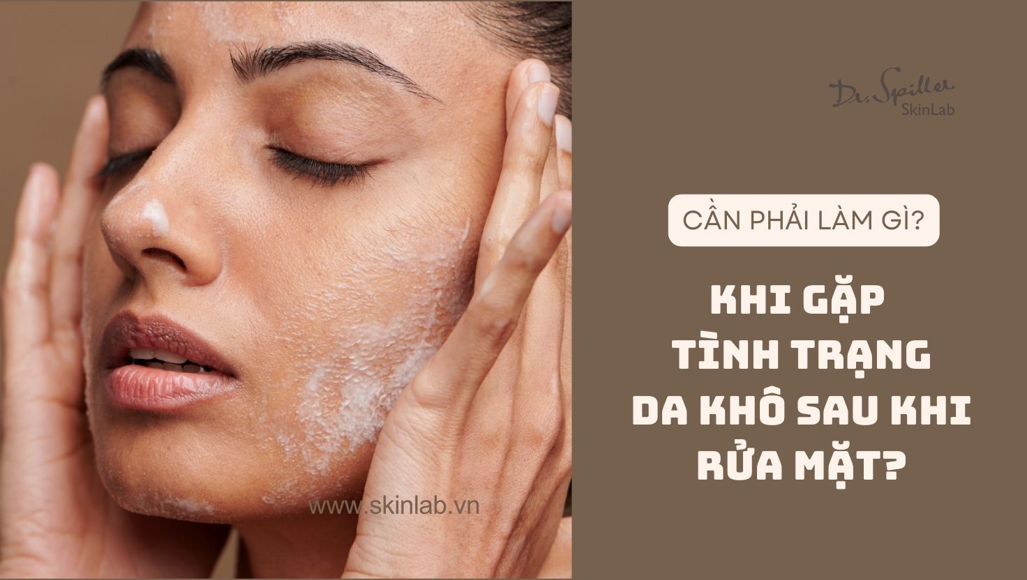 Da khô sau khi rửa mặt: Cách cải thiện và sản phẩm phù hợp