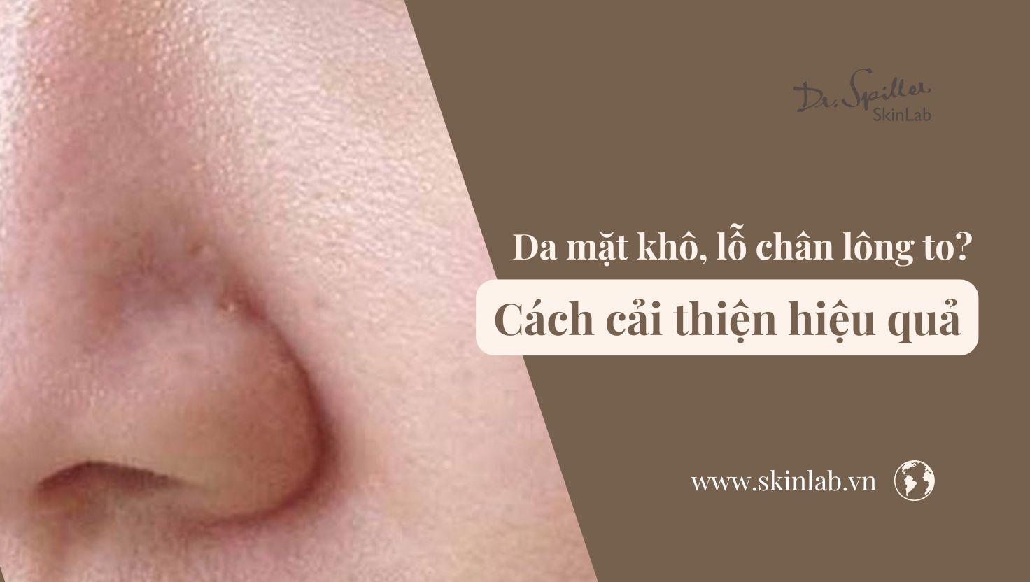 Da mặt khô lỗ chân lông to: Cách cải thiện hiệu quả