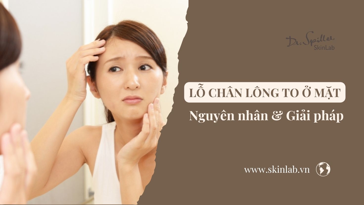 Da mặt lỗ chân lông to: Nguyên nhân và cách khắc phục hiệu quả