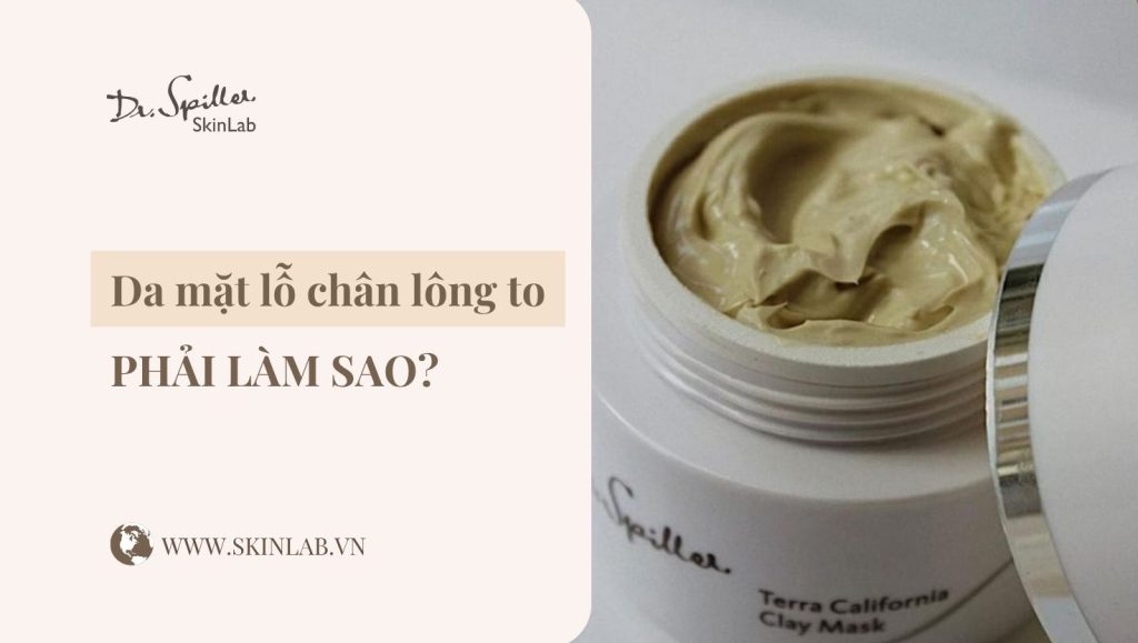 Da mặt lỗ chân lông to phải làm sao? Giải pháp hiệu quả