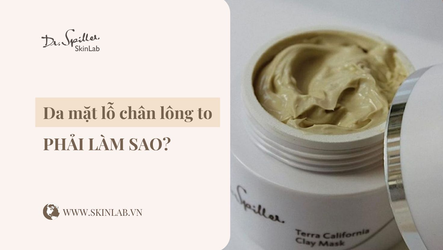 Da mặt lỗ chân lông to phải làm sao? Giải pháp hiệu quả