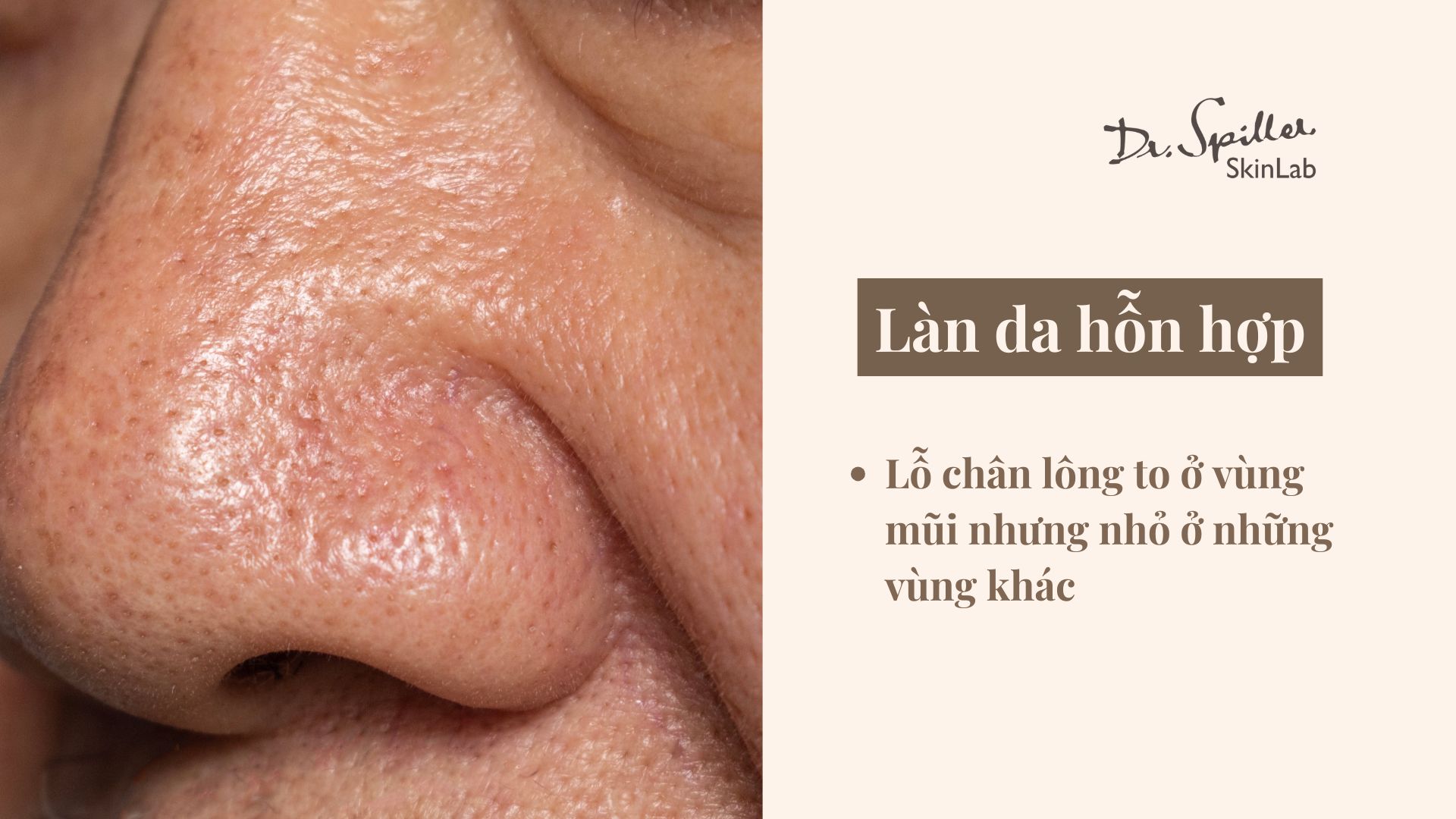 Dầu dưỡng tự nhiên cho da hỗn hợp: Đặc điểm của da hỗn hợp
