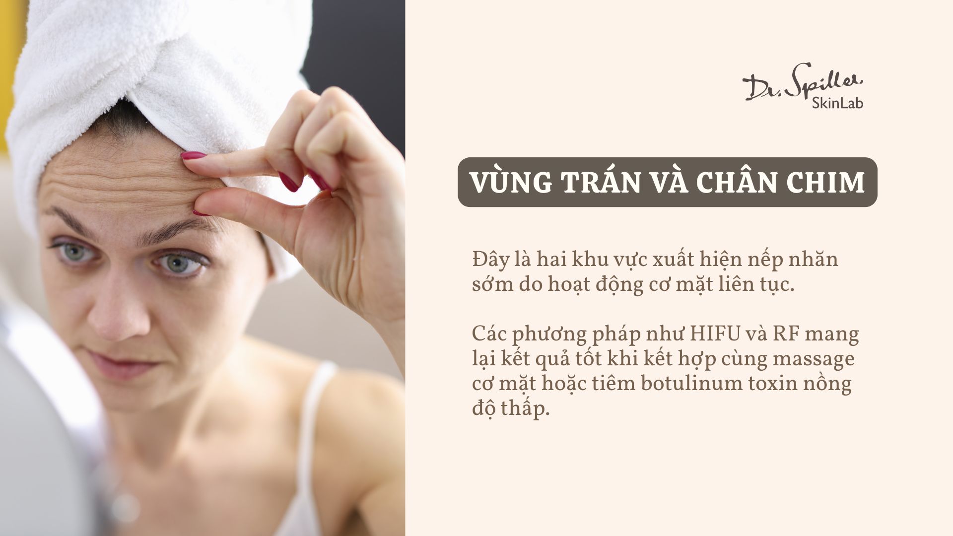 Những vùng da thường được điều trị bằng công nghệ không xâm lấn
