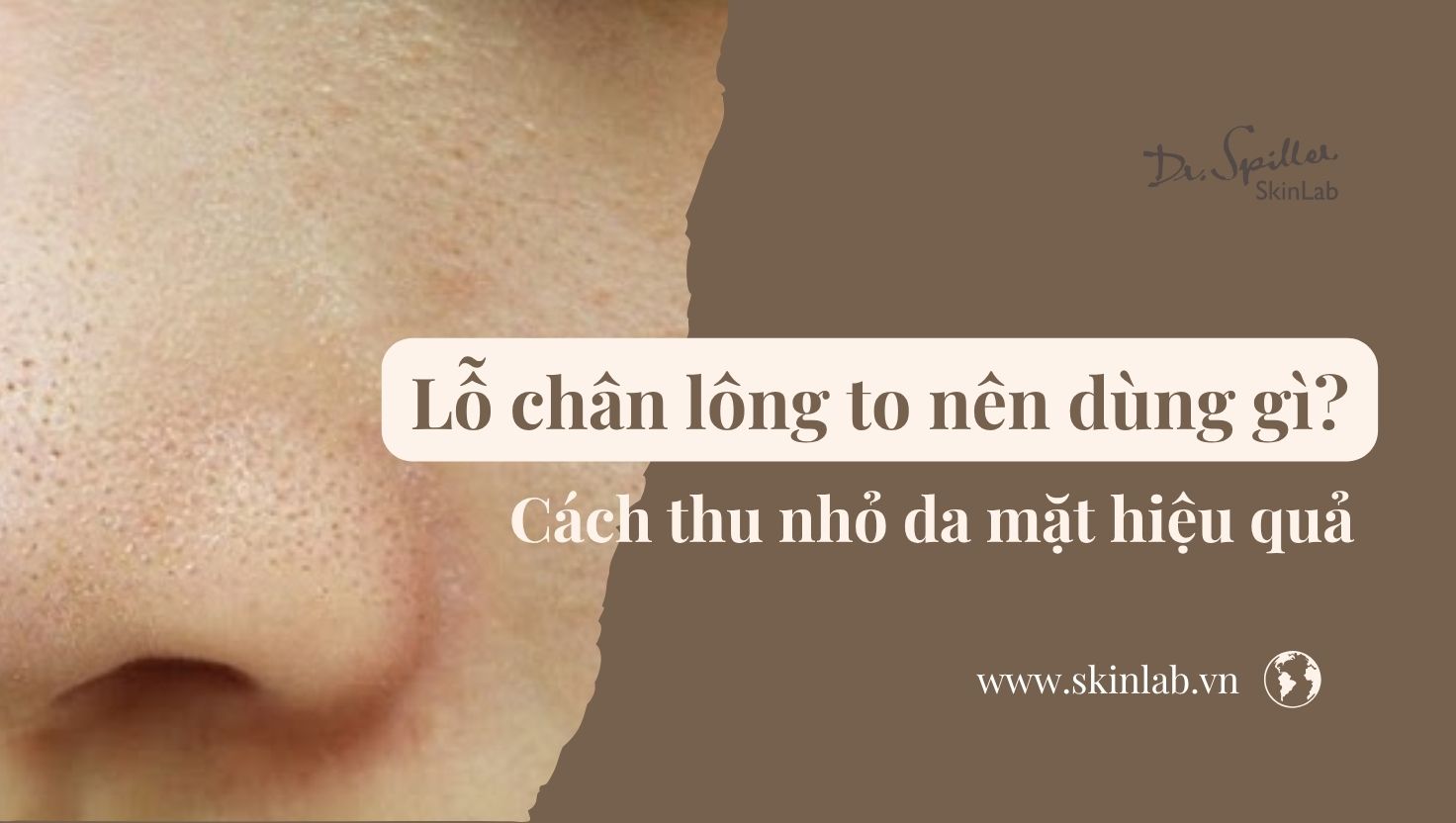 Lỗ chân lông to nên dùng gì? Cách thu nhỏ da mặt hiệu quả