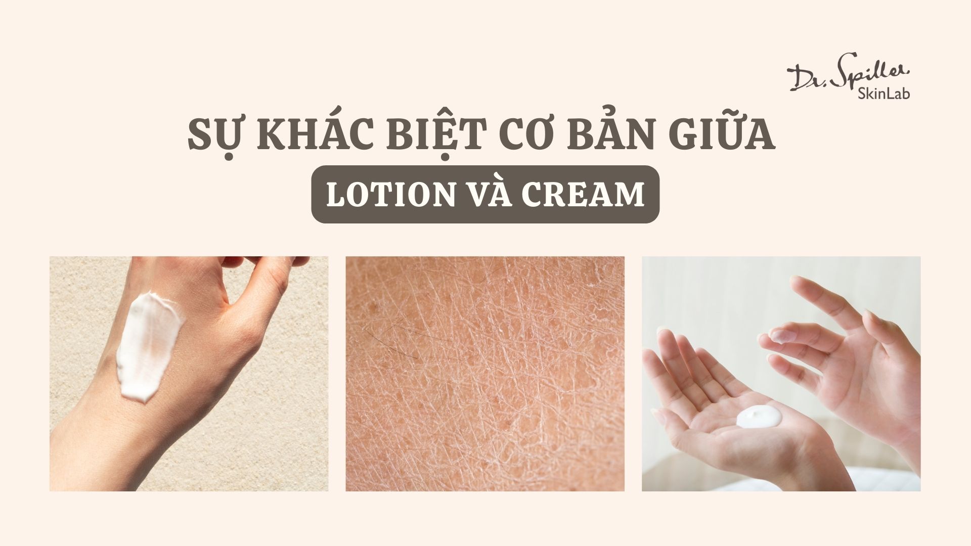 Sự khác biệt cơ bản giữa lotion và cream