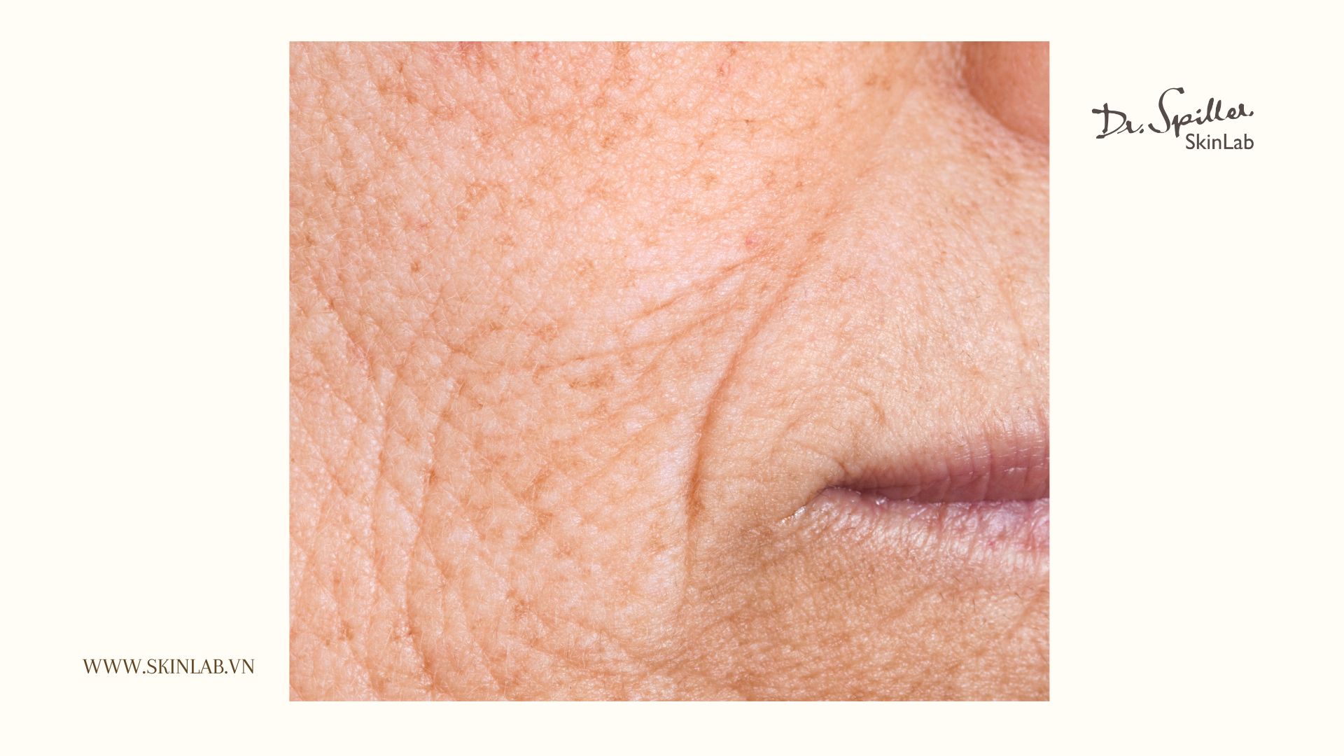 Nên dùng retinol từ bao nhiêu tuổi?