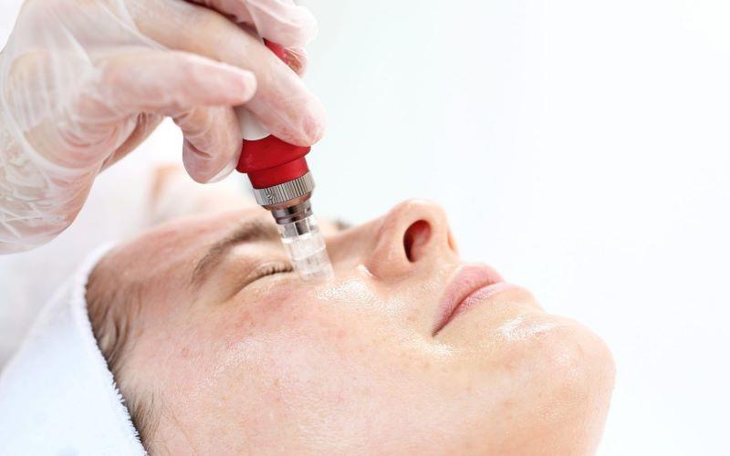 Những lợi ích vượt trội của phi kim trong cải thiện làn da lão hóa