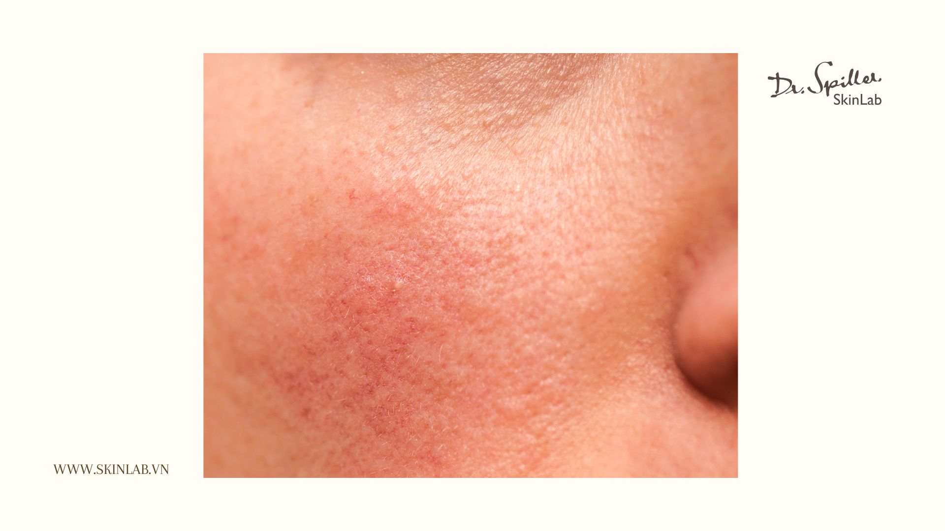 Nguyên tắc quan trọng khi xây dựng routine skincare cho da hỗn hợp