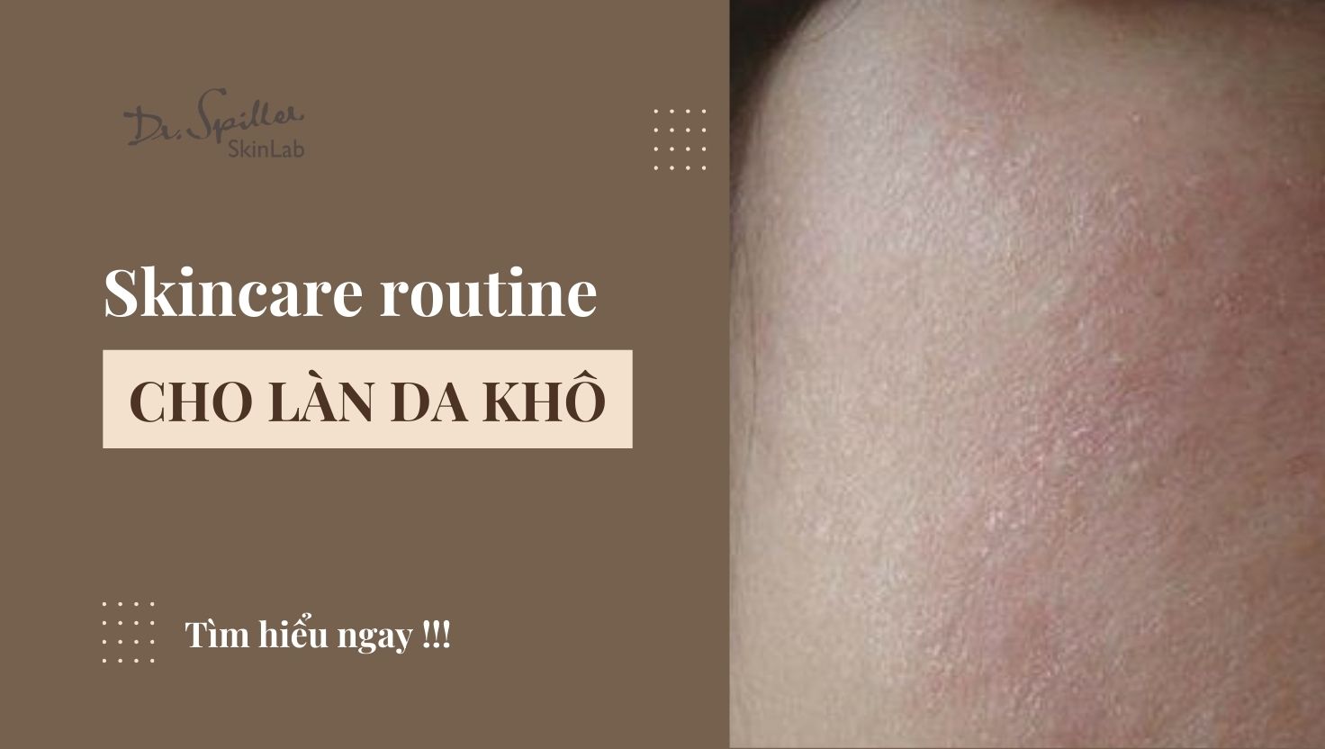 Skincare routine cho da khô: Quy trình chăm sóc hiệu quả