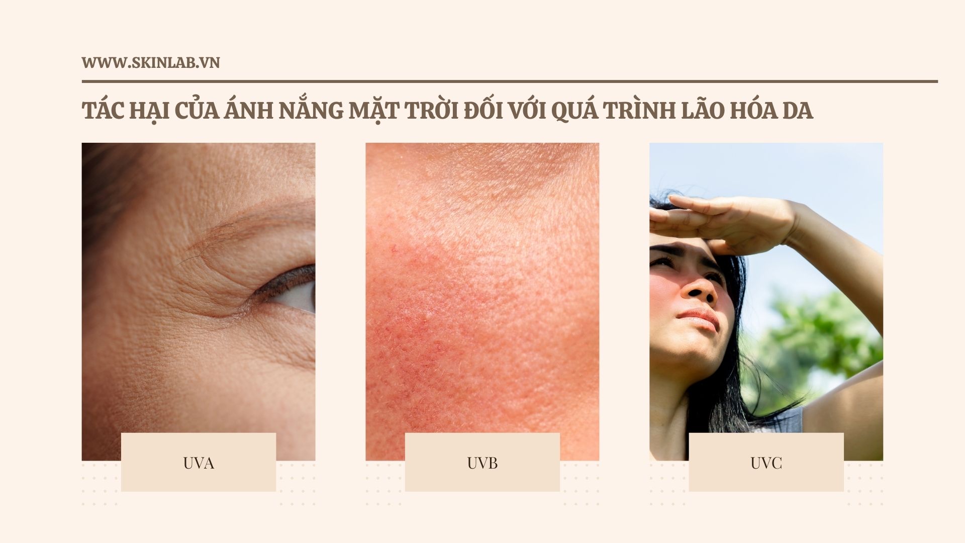 Tác hại của ánh nắng mặt trời đối với quá trình lão hóa da