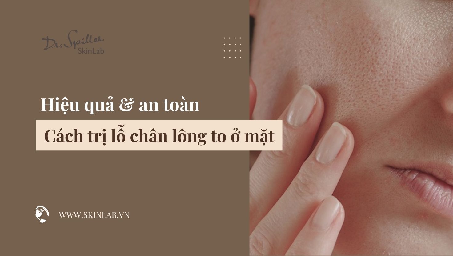 Cách trị lỗ chân lông to ở mặt hiệu quả và an toàn