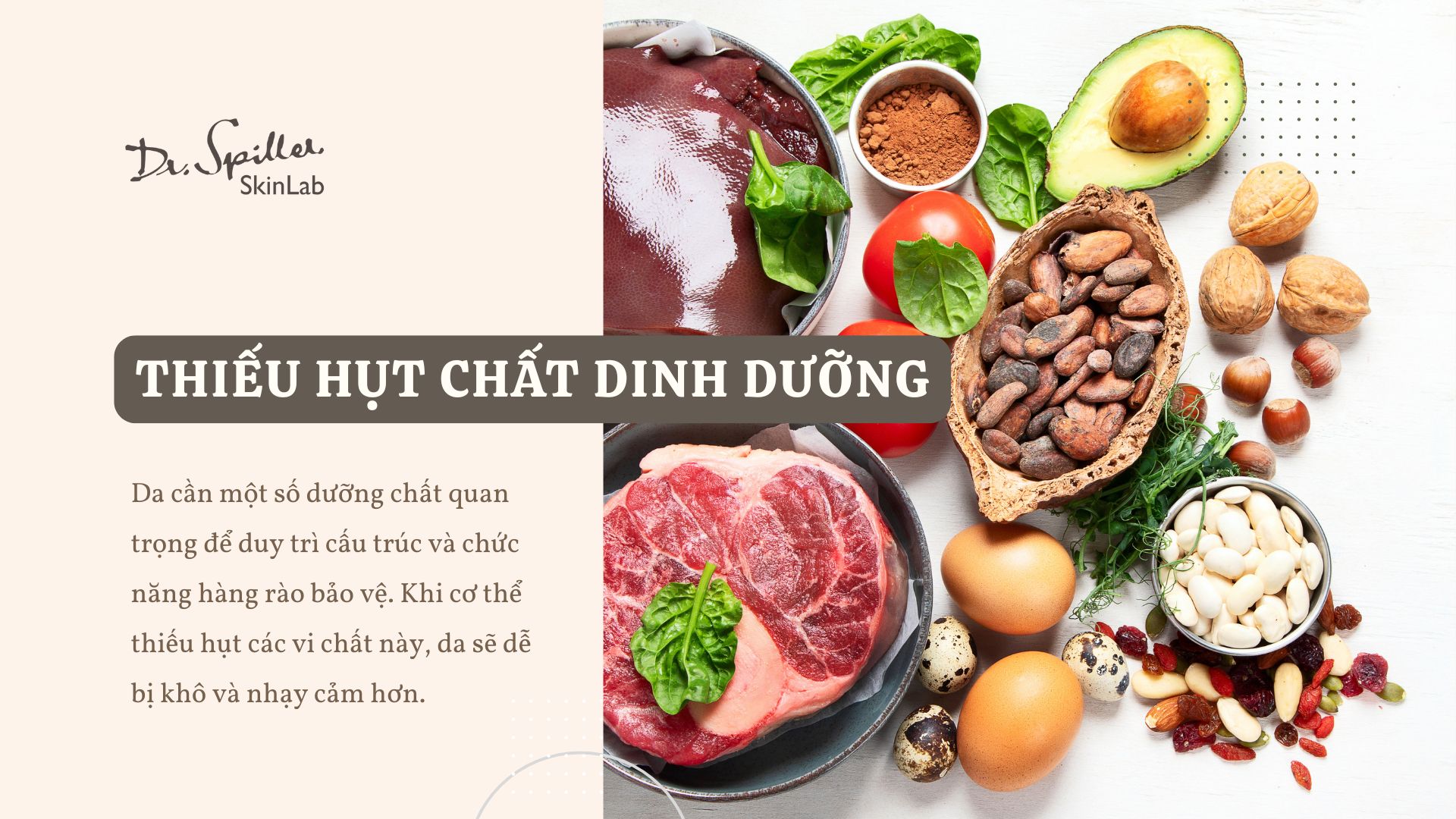 Vì sao da bị khô? Có thể nguyên nhân do thiếu hụt dinh dưỡng