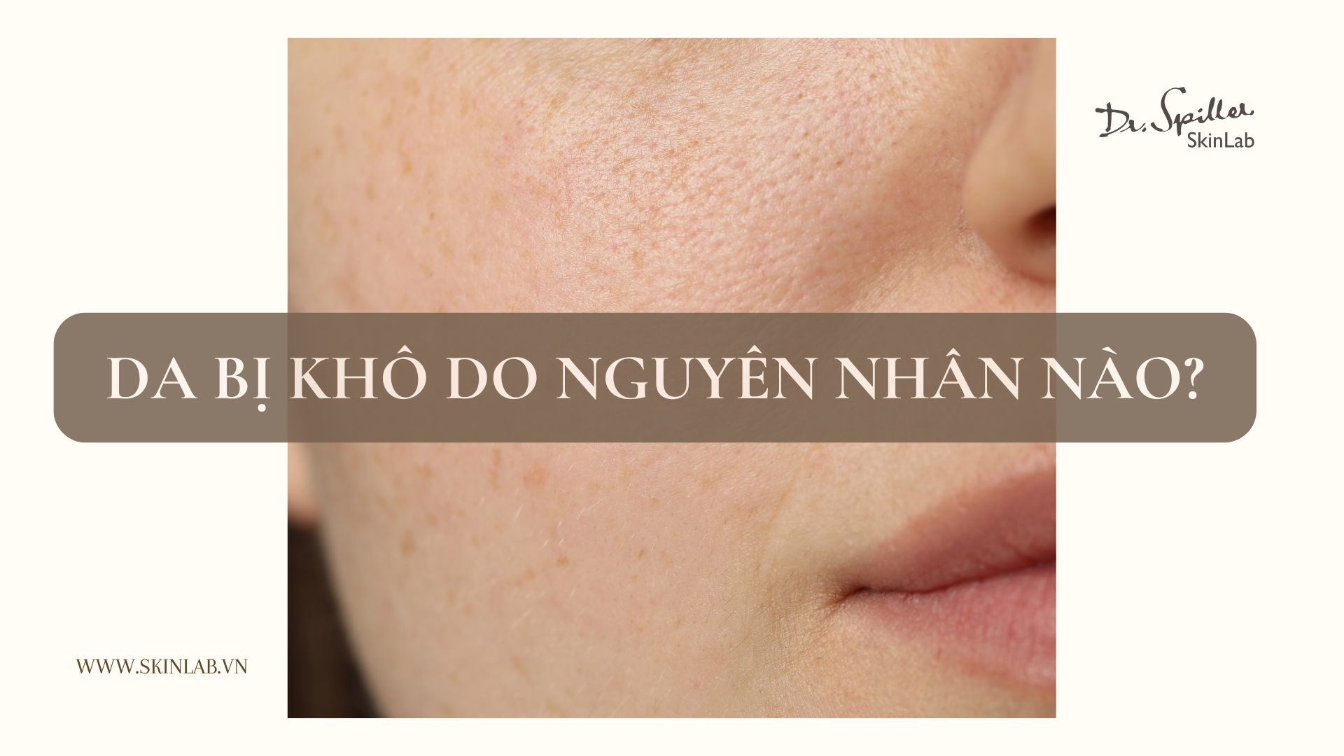 Vì sao da bị khô? Nguyên nhân và giải pháp chuyên sâu